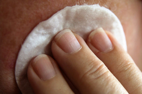 Taches blanches sur la peau : causes, gravité & traitement